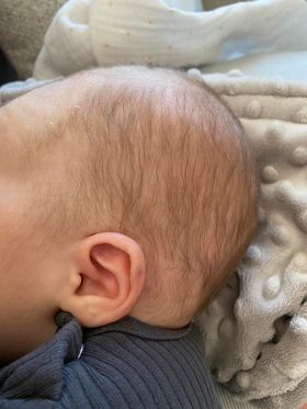 Szüléstörténet 178, Ákos baba