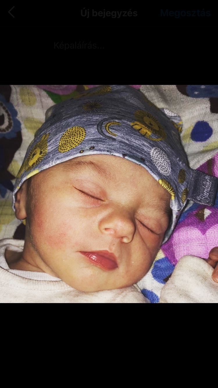 Szüléstörténet 199, Léda baba