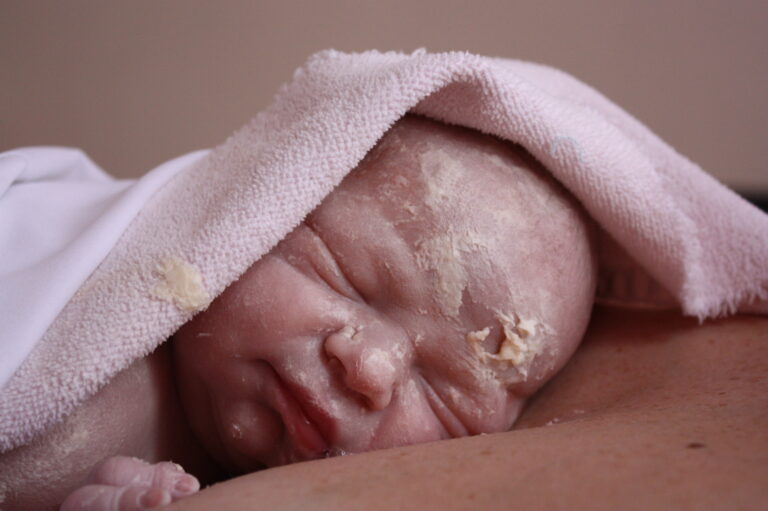 Szüléstörténet 221, Szofi baba